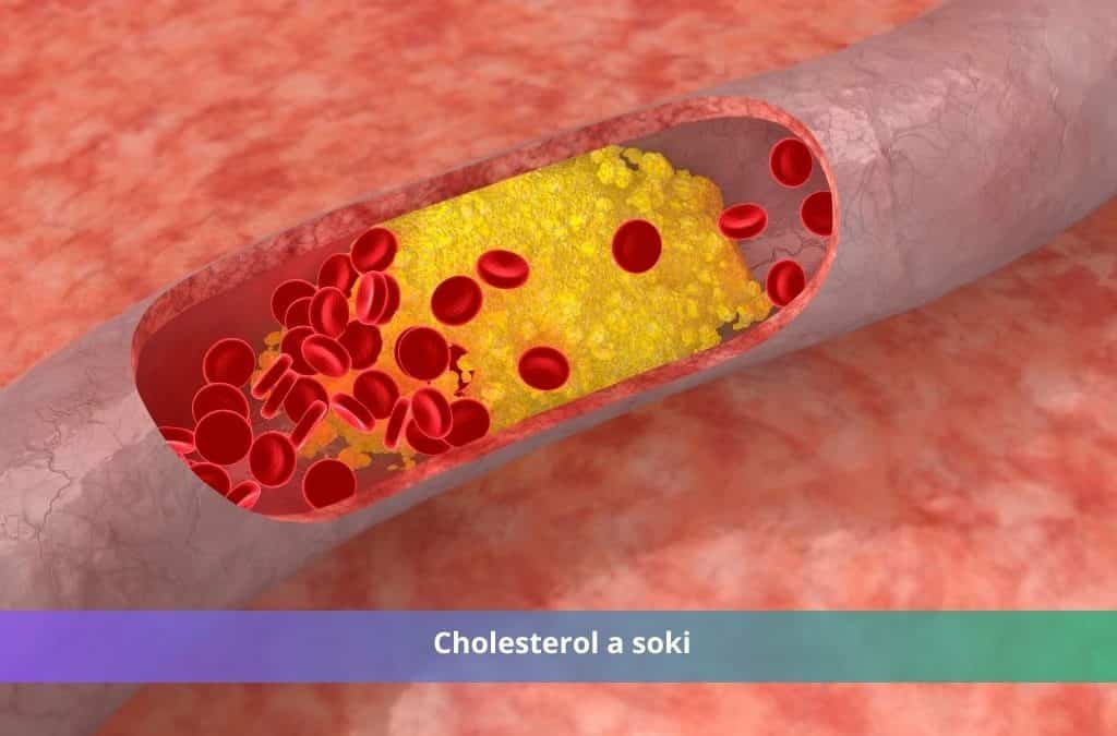 cholesterol a soki