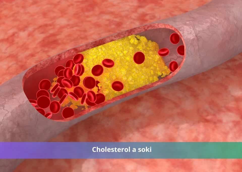 cholesterol a soki